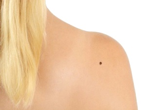 Hautarztpraxis Dr. Kathrin Laaff, Doctor-medic Stefan-Petru Ciuloi, Fachärzte für Dermatologie, Allergologie